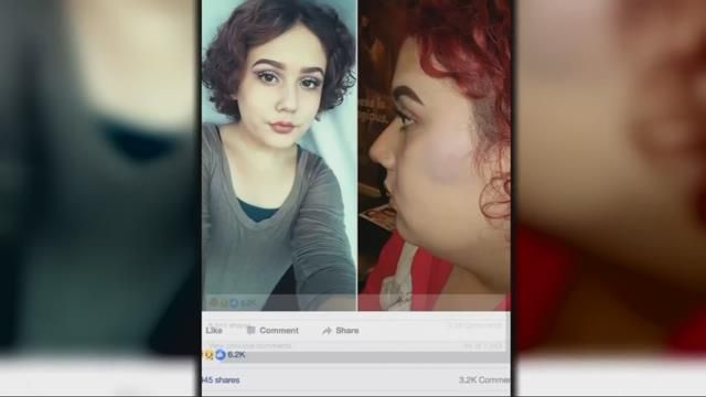 Transgender student says she was punched, bullied by classmate at Vancouver school